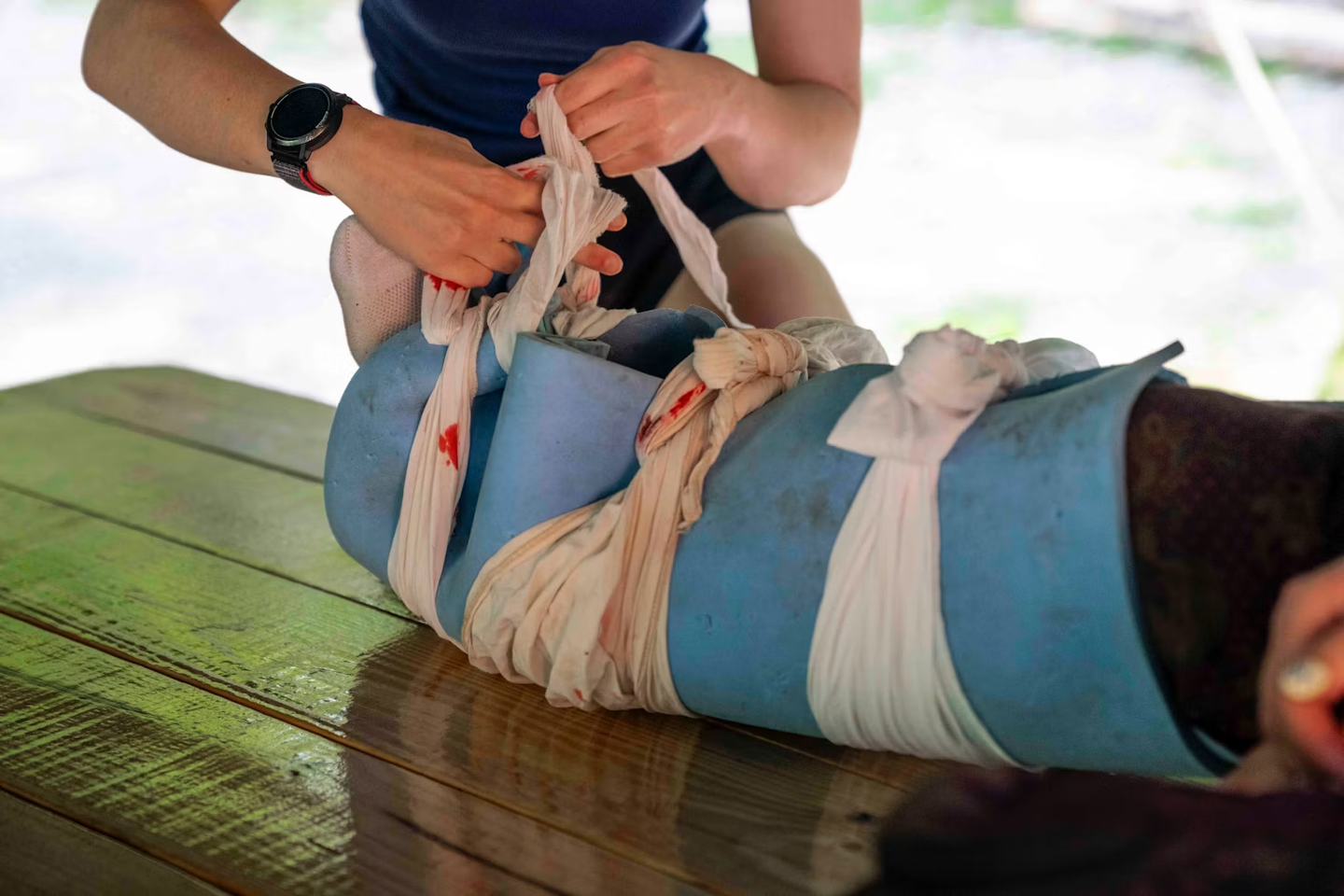 Hands building an improvised splint on someone's lower leg using a sleeping pad.